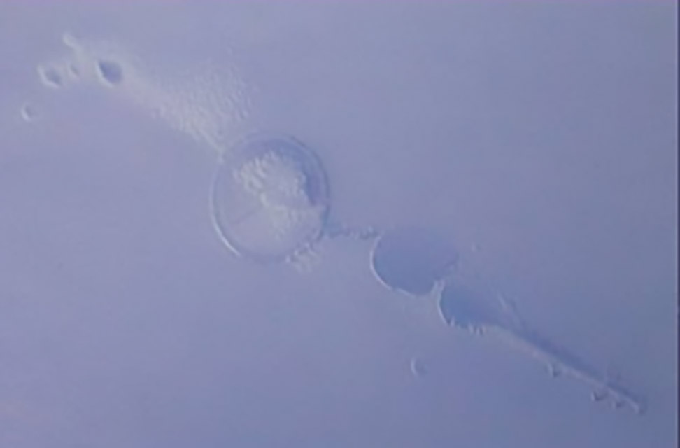 360-1-困气：注塑时带入空气